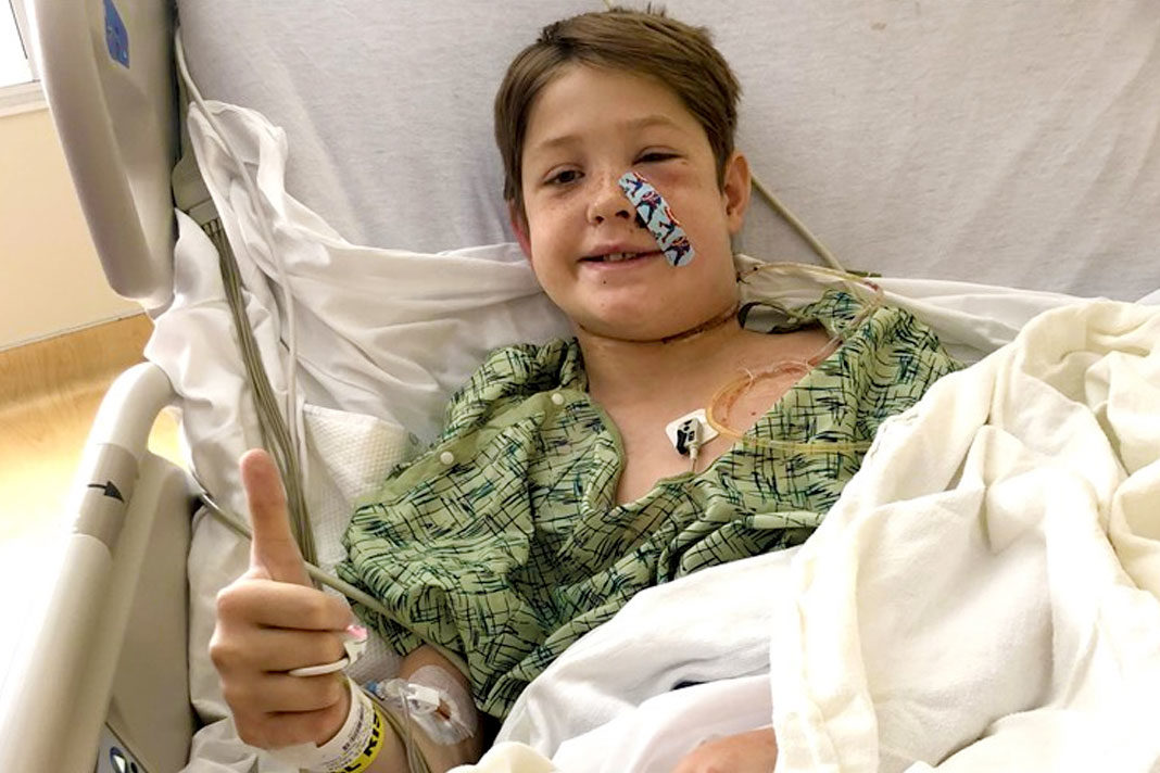 boy-miraculously-survives-after-face-impaled-by-meat-skewer