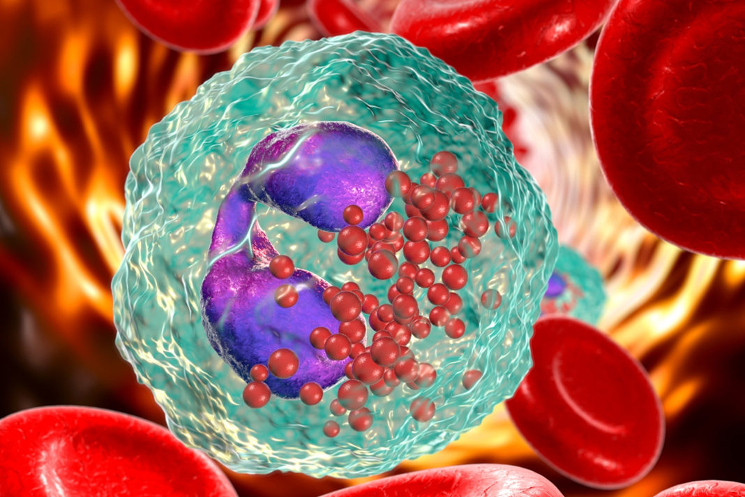 israelis-find-asthma-causing-blood-cells-can-fight-colon-cancer Asthma causing blood cells