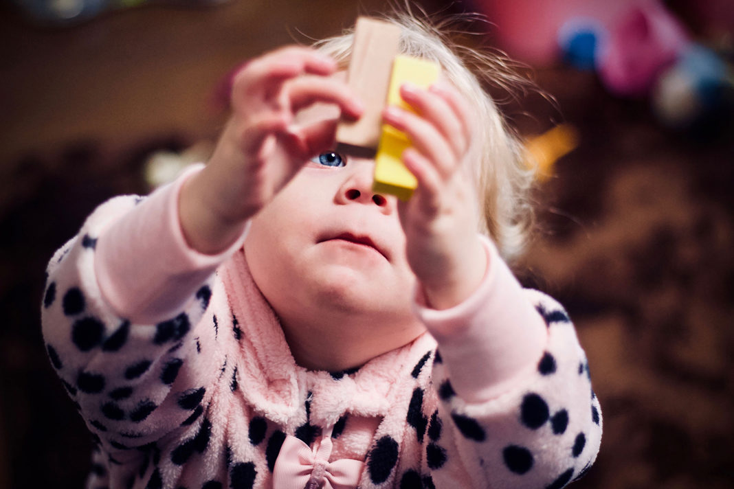 children-thriving-after-doctors-branded-them-not-viable Little Girl