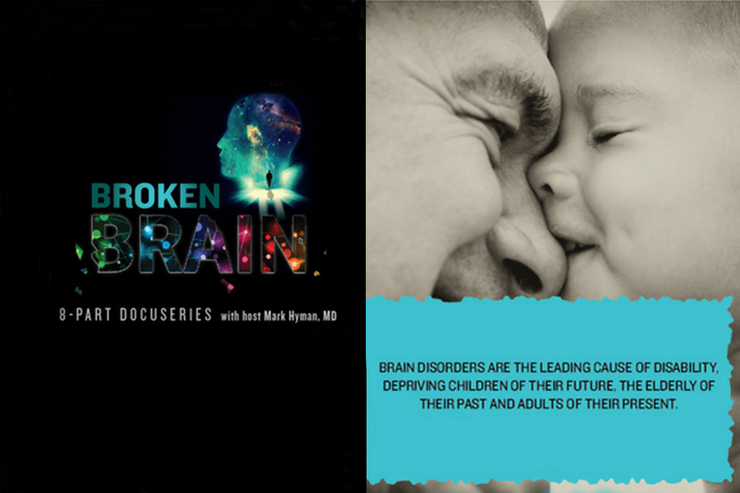 Broken Brain