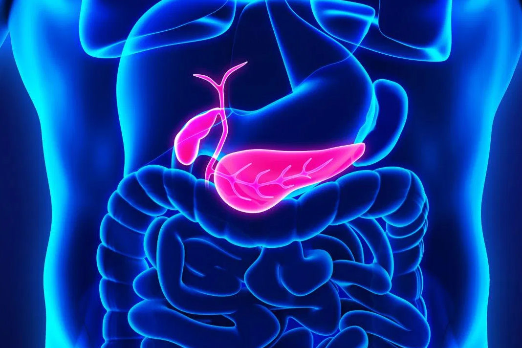 Pancreatic cancer