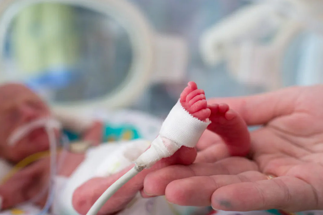 Preemies-Breathe-Easier-with-Israeli-Breakthrough Premature Babies