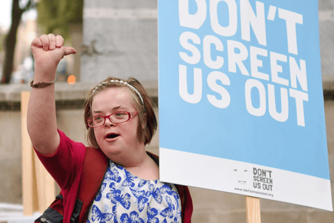 1600-urge-pm-to-protect-downs-syndrome-babies-from-abortion-in-northern-ireland Downs Syndrome