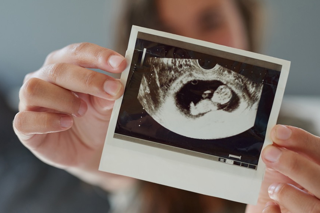 abortion-workers-admit-abortion-is-killing-if-youre-not-okay-with-that-you-cant-work-here Woman with ultrasound image