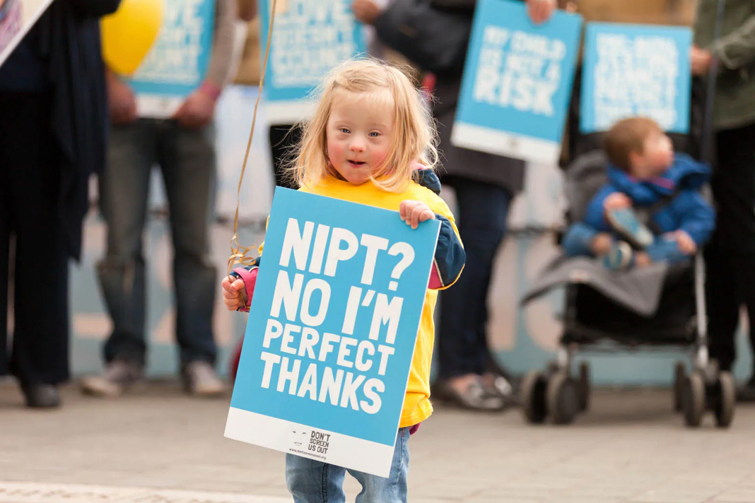 downs-syndrome-campaigners-call-for-equal-protection-from-abortion Little Downs Syndrome Girl with protest sign