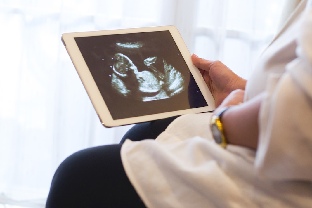 pregnant-and-worried-about-coronavirus-heres-what-you-need-to-know Pregnant woman
