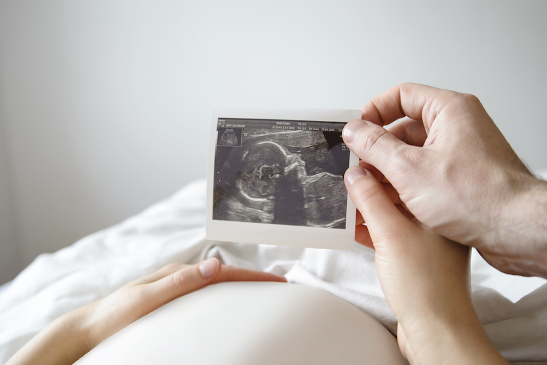 abortion-is-a-human-rights-issue-not-a-womens-issue-so-why-dont-men-have-a-say husband and wife looking at baby scan