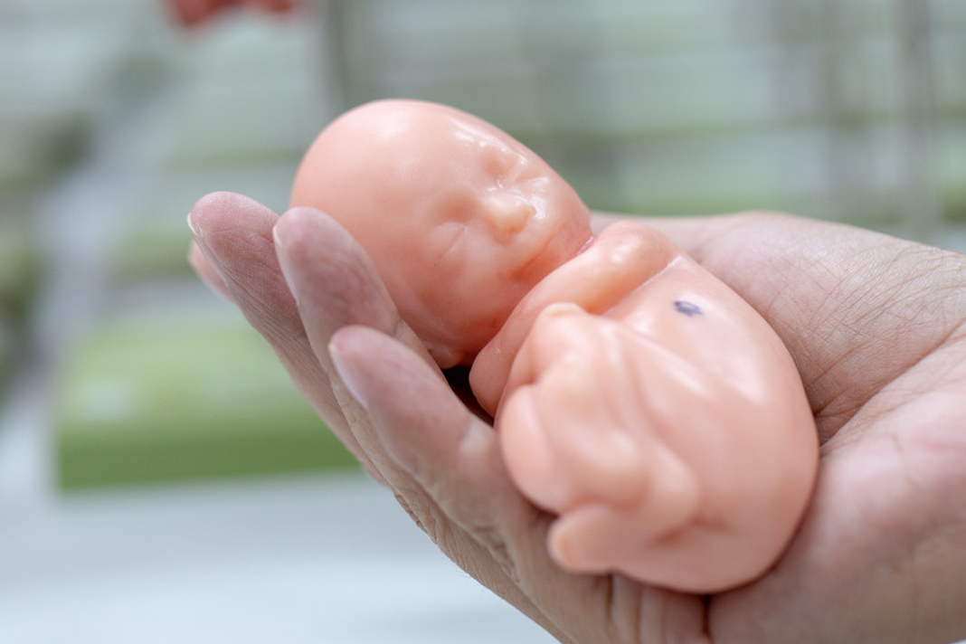 spanish-lawmakers-want-to-jail-pro-lifers-for-showing-models-of-fetuses-to-women models of fetuses