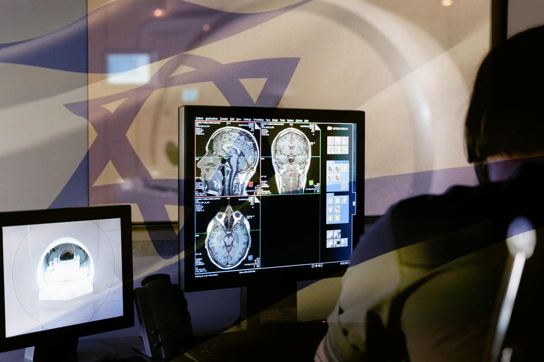 israeli-researchers-test-ai-based-radiation-methodology-to-eradicate-aggressive-tumors