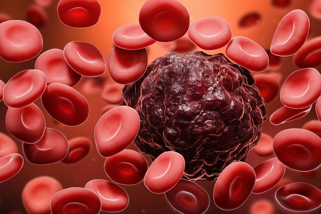 breakthrough-israelis-develop-revolutionary-blood-cancer-treatment breakthrough-israelis-develop-revolutionary-blood-cancer-treatment