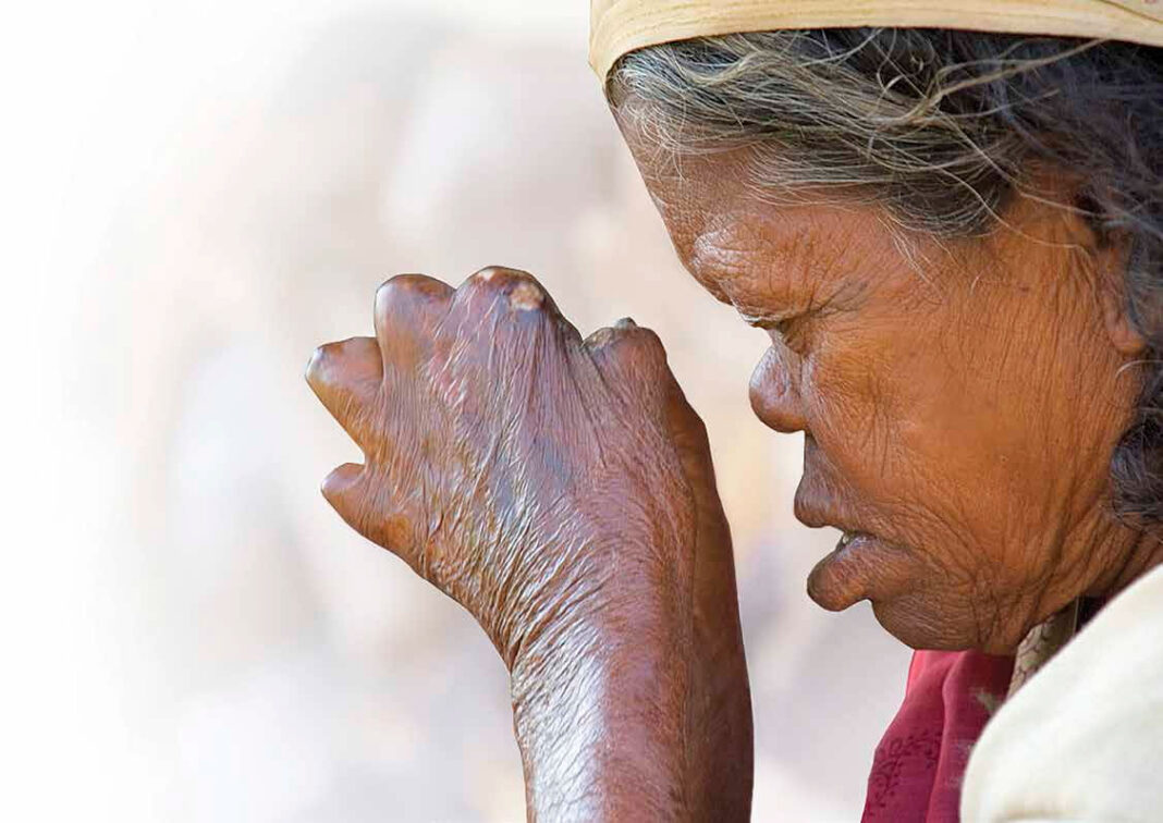 download---The-Leprosy-Mission-1